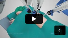 Robotic Lung Surgery